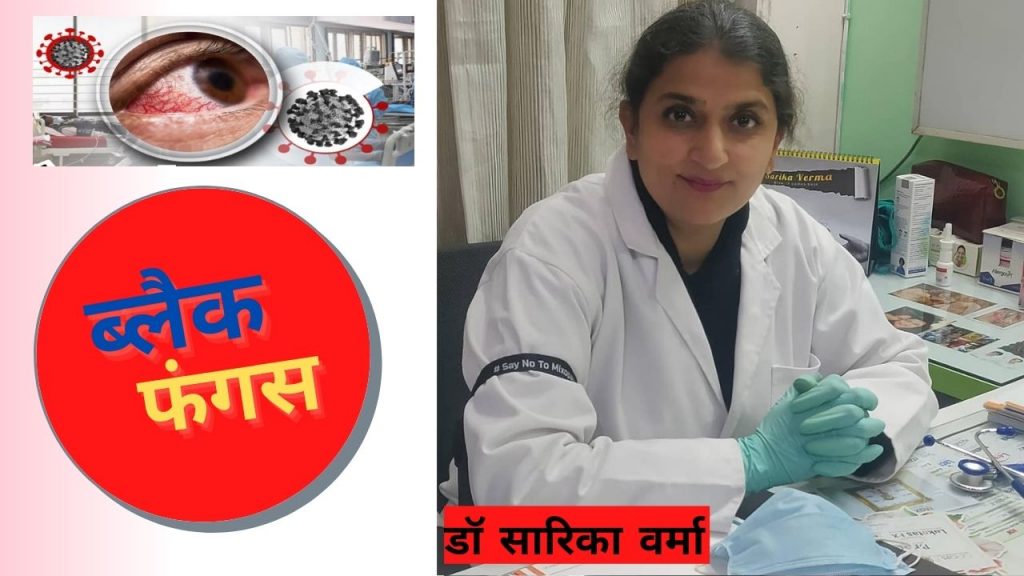 white fungus, Lungs, eyes, Black Fungus, Coronavirus, black fungus treatment, black fungus kya hai, black fungus ka ilag kya hai, corona symptoms, Dr Sarika Verma,