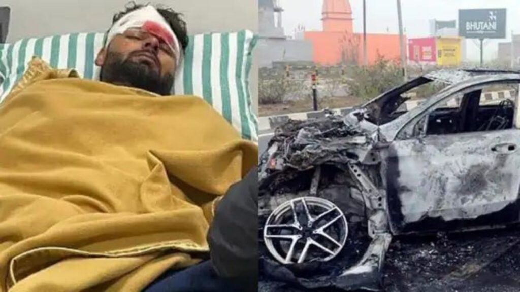 Rishabh Pant, Rishabh Pant Car Accident, Rishabh Pant Accident News, Rishabh Pant Accident, Rishabh Pant Car, Rishabh Pant Latest News, Rishabh PantUpdate, Max Hospital Dehradun, Rishabh PantCar Photo, Rishabh Pant Photo, Rishabh Pant Hindi News, Rishabh Pant Ka kya haal hai, Rishabh Pant Family, Rishabh Pant Biography, Rishabh Pant Accident, rishabh pant medical reports, rishabh pant mri report, Rishabh Pant Accident Updates, Rishabh pant Admitted To Hospital, Rishabh Pant Car Accident, Rishabh pant Injured in Accident, Rishabh pant Severely Injured Accident, Rishabh pant Hospital, Rishabh pant Accident News, ऋषभ पंत एक्सीडेंट, Cricket Hindi News, Cricket Hindi News, Cricket Hindi New,