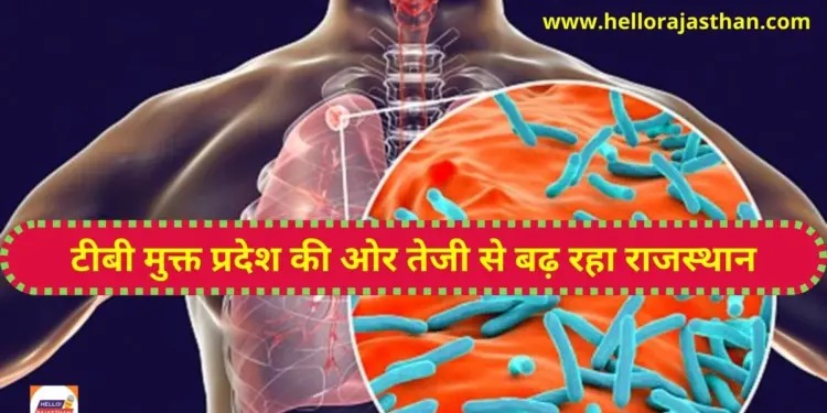 viksit bharat sankalp yatra, Rajasthan , TB free , TB treatment, Rajasthan TB Treatment, Best doctor in rajasthan, Best hospital for tb ,